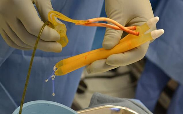 implantes no pene